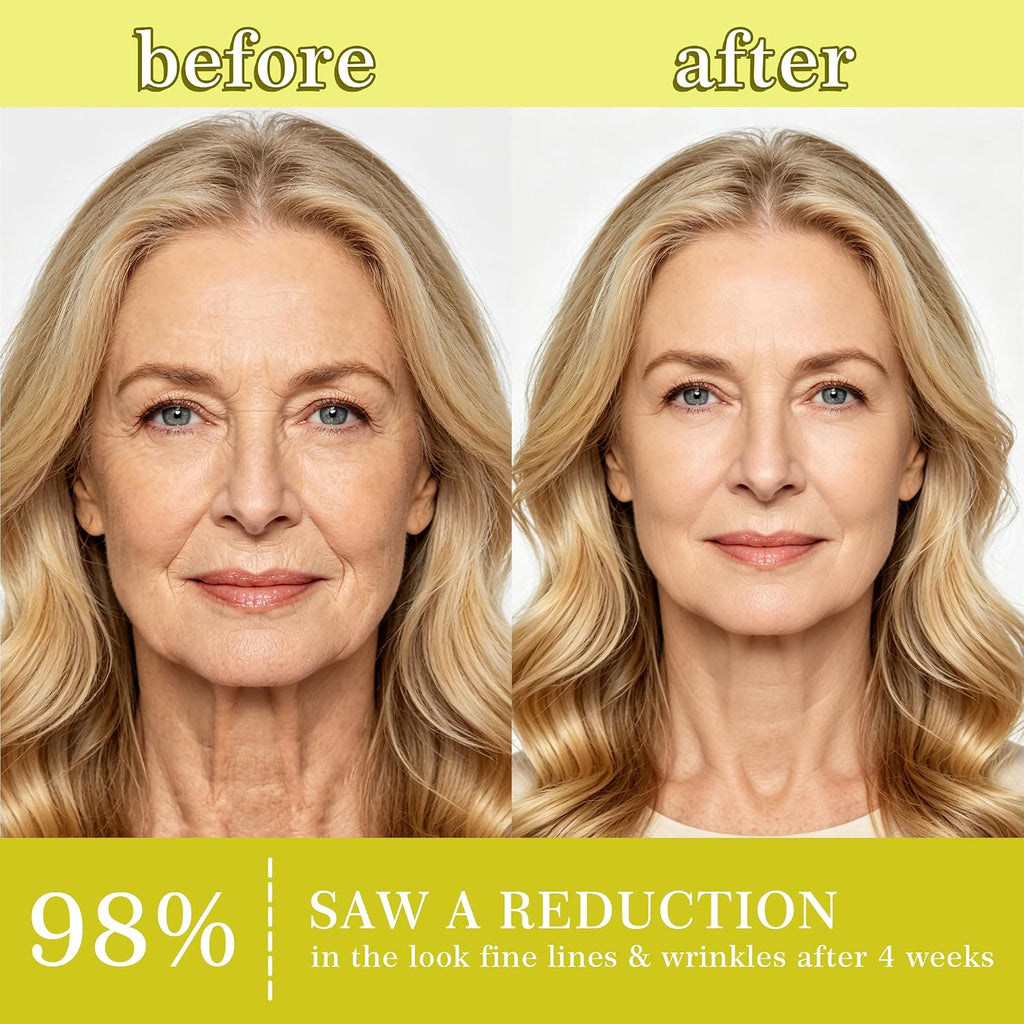 Botoxmix & Vita a Retinal Shot Tightening Booster | Wrinkle-Lift Tightening Cream, Collagen Lifting Serum, Retinoid for Anti-Aging, Pore Minimizer, Wrinkles & Fine Lines, Firmer Skin (15Ml X 2 PCS)