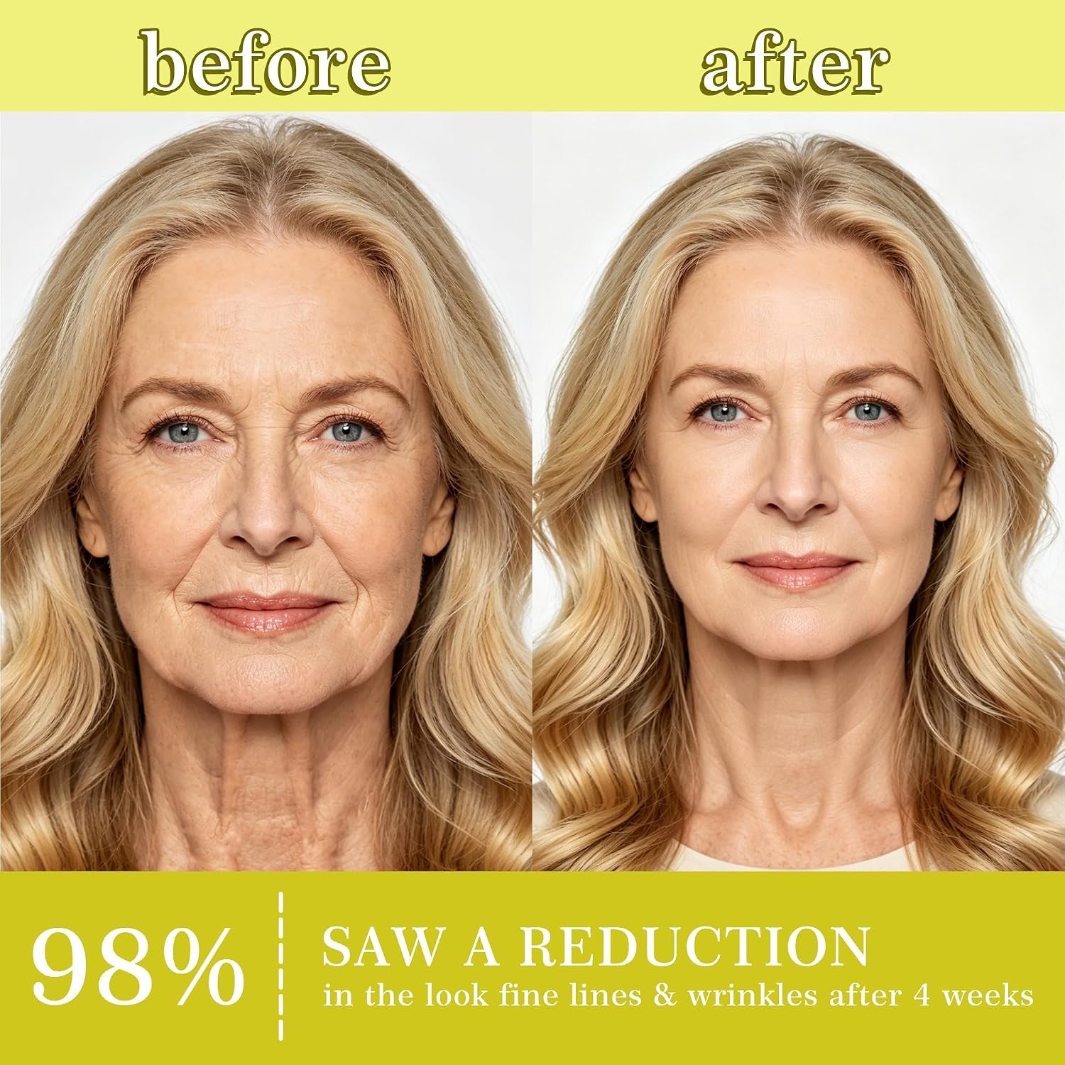 Botoxmix & Vita a Retinal Shot Tightening Booster | Wrinkle-Lift Tightening Cream, Collagen Lifting Serum, Retinoid for Anti-Aging, Pore Minimizer, Wrinkles & Fine Lines, Firmer Skin (15Ml X 2 PCS)